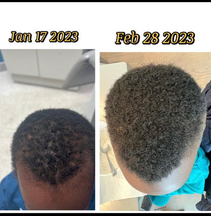 Flourish: Hair growth and scalp stimulator